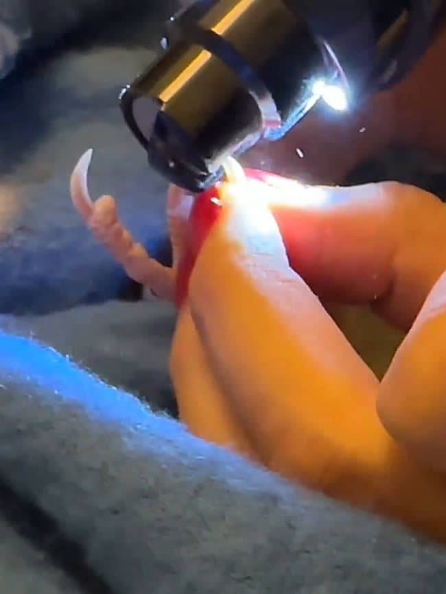 A curled nail being filed, the toe held between two fingers